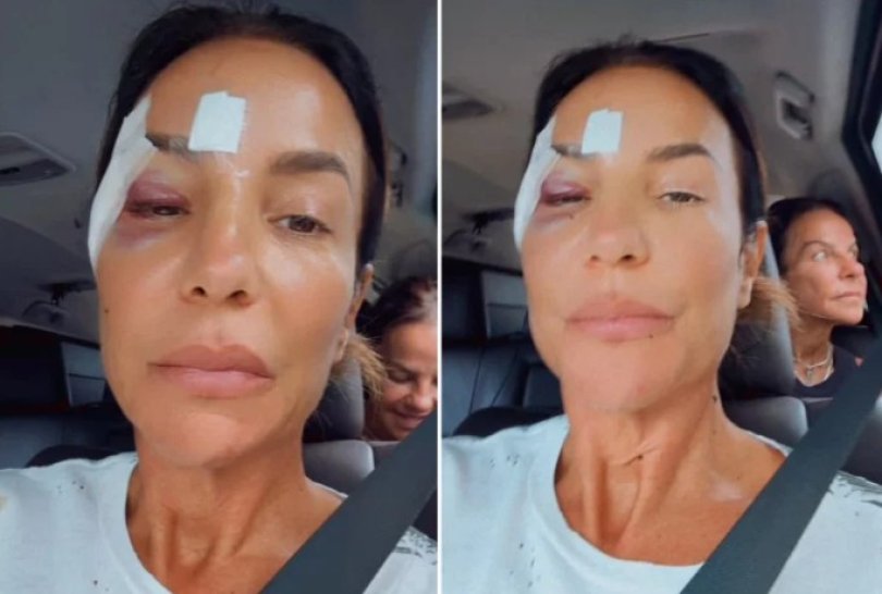 Ivete Sangalo deixa hospital após diagnóstico...