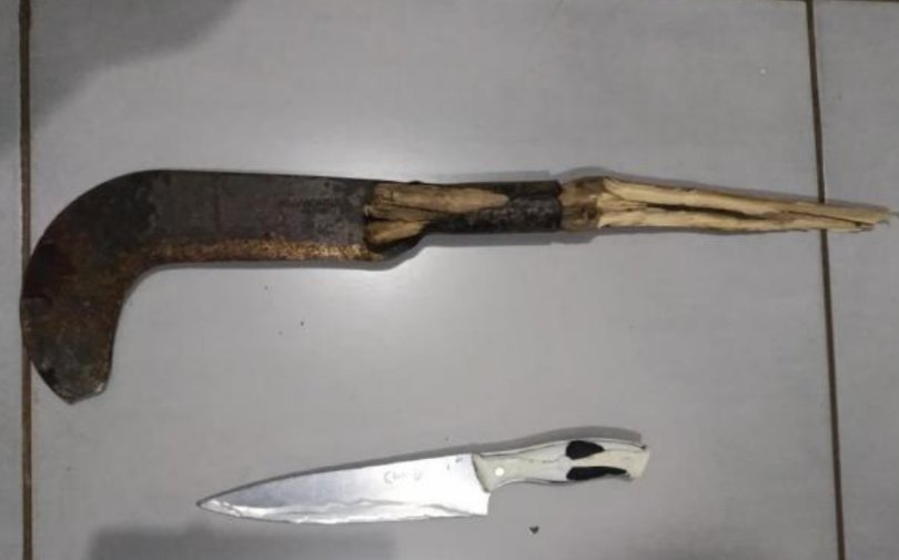 Covarde atacou esposa com foice e ainda agrediu criança...