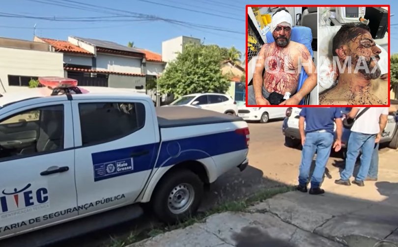 Vereador que teve orelha cortada em roubo recebe alta de hospital com esposa...
